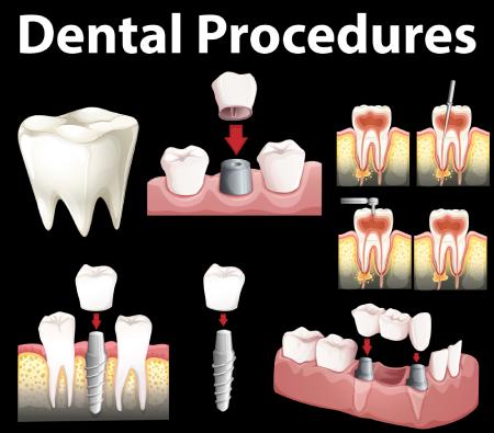 bluegrass-dental-dental-procedures