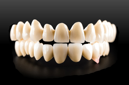 cdental-veneers