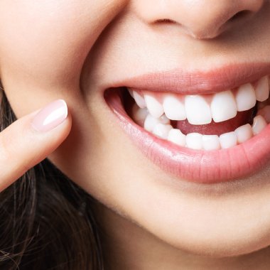 dental-teeth-whitening