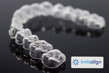 invisalign-liners