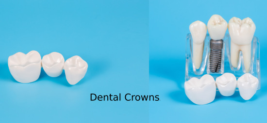 plastic-dental-crowns.jpg